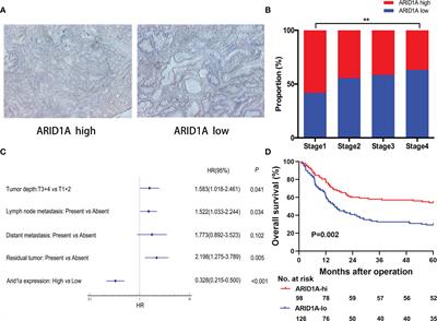 ARID1A Downregulation Predicts High PD-L1 Expression and Worse Clinical Outcome in Patients With Gallbladder Cancer